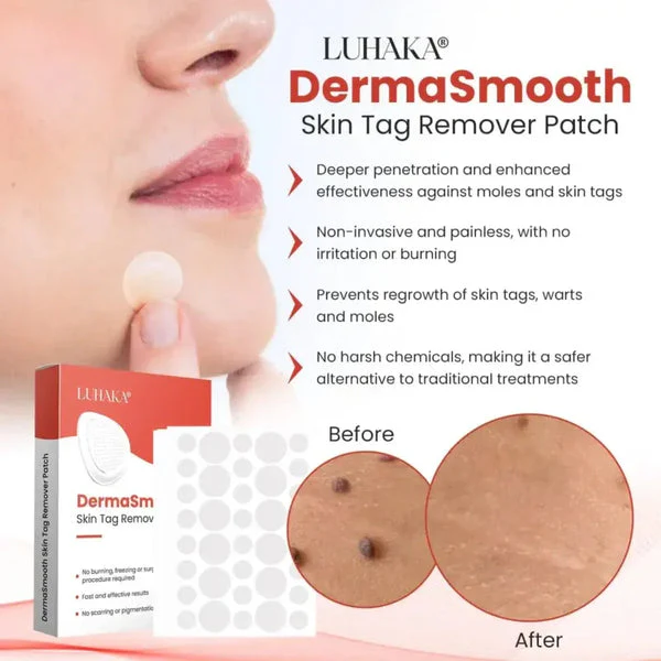 DermaSmooth Skin Tag Remover Patch ? Fast, Safe, And Painless Skin Tag And Mole Removal Solution With No Scarring Or Pigmentation - Image 2