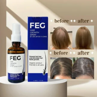 FEG PLUS Hair & Beard Regrowth Spray ? Anti Hair Loss Formula with Minoxidil, Redensyl & Natural Extracts (50ml)