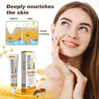 Botox Bee Venom Wrinkle Cream | Anti?Aging Moisturizer | Collagen Boost | Reduce Wrinkles & Fine Lines 30gm