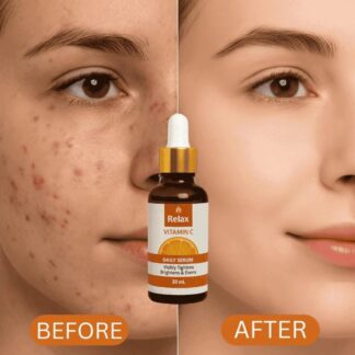 Relax Vitamin C Daily Face Serum ? Brightening, Anti-Aging & Hydrating Formula For Healthy Radiant Skin (30ml)