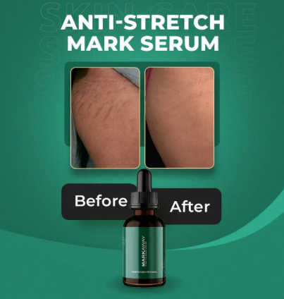 Markaway Stretch Mark Serum Herbal Formula for Scars & Skin Elasticity 30ml Nourishing, Repairing & Firming Skin Treatment - Image 4