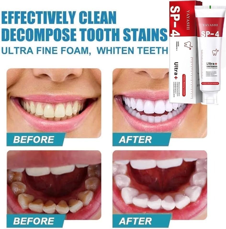 Yayashi SP-4 Ultra Whitening Toothpaste ? 150ml Probiotic Stain Remover for Bright, Healthy Teeth - Image 4