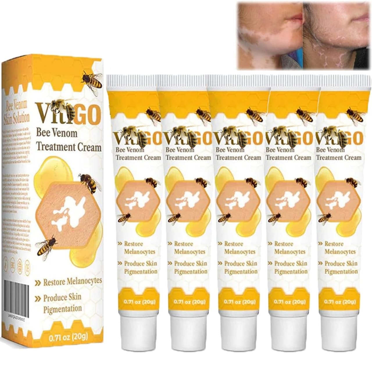 Bee Venom Vitiligo Treatment Cream - Restore Melanocytes & Skin Pigmentation - Natural Melanin Care Ointment for Leukoplakia (20g) - Image 3