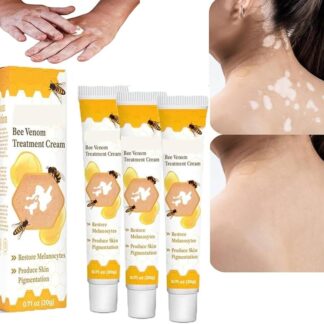 Bee Venom Vitiligo Treatment Cream - Restore Melanocytes & Skin Pigmentation - Natural Melanin Care Ointment for Leukoplakia (20g)