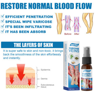 30ml Varicose Veins Treatment Spray Varicose Vein Treatment Cream Repair Varicocele Removal Pain Relief Kidney Inflammation Legs Vein Health Care Spray