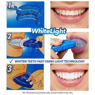 White Light Teeth Whitening Brightener | No box card packing  and cell operated.