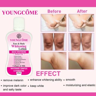YOUNGCOME 60ml Face Body Whitening Lotion Underarm Brightening Private Underarm Body Cream Legs Whitening Parts