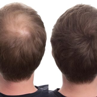 CABOKI HAIR BUILDING FIBERS - 25g