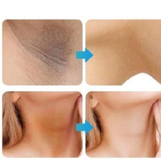 Whitening Cream for sensitive Areas underarm and private Areas - 30g