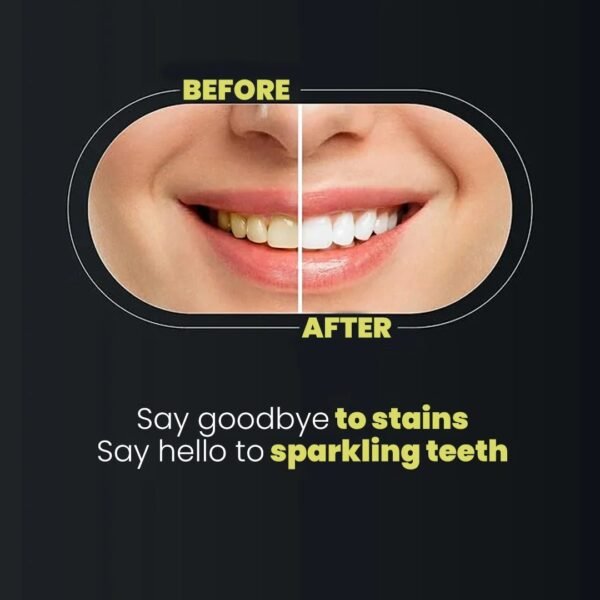 2cb40c69cbfa3a072d16a8116ccf7e40 Teeth Whitening Strips 3D Gentle Stain Removing Enamel Safe Bright Smile Daily Treatment 14 Strips