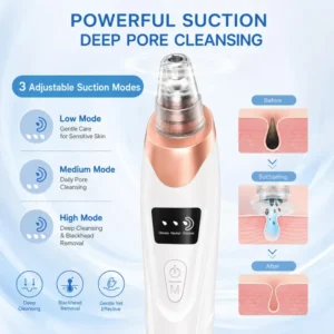 493c118f9b190409d4669b518fc08219 Blackhead Beauty Instrument / Pore Cleaner
