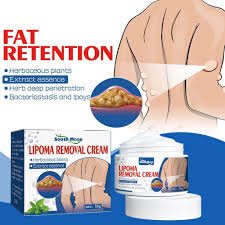 79857365a6b7f7f72ff516b5e9b1f831 50G Lipoma Removal Cream Herbal Treatment For Safe And Effective Lipoma Reduction