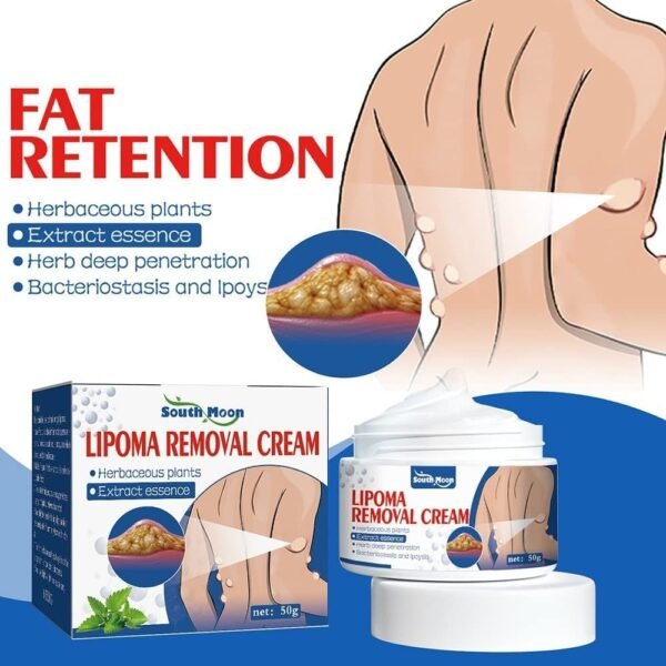 b0962c0a667fe4d197943faab145e262 South Moon Lipoma Removal And Body Smoothing Cream 50g Herbal Natural Lump And Skin Knot Relief Ointment