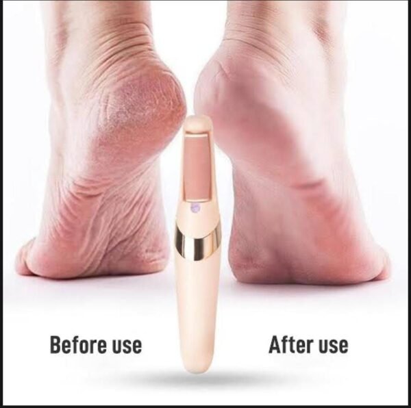855851080f323c2e540a705e2b04399d Rechargeable Electric Pedi Foot Filer Effective Callus Remover For Soft Smooth Feet With Easy Use And Reliable Performance